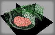 Magnet Resonance Tomography