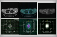 Dual-Modality PET/CT