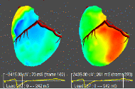 Mapping the Heart