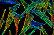 Actin Filament Orientation