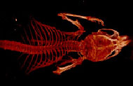 Skeleton in the Scanner