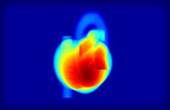 X-ray CT of the Heart