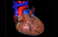 Human Heart Model