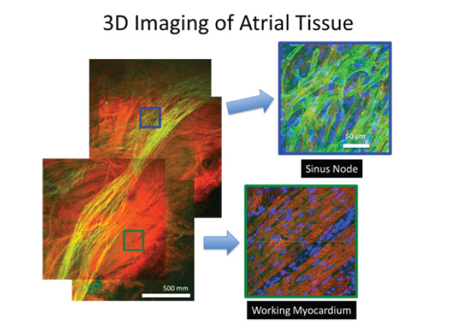 atrial-tissue