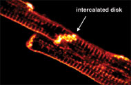 Living Heart Cells